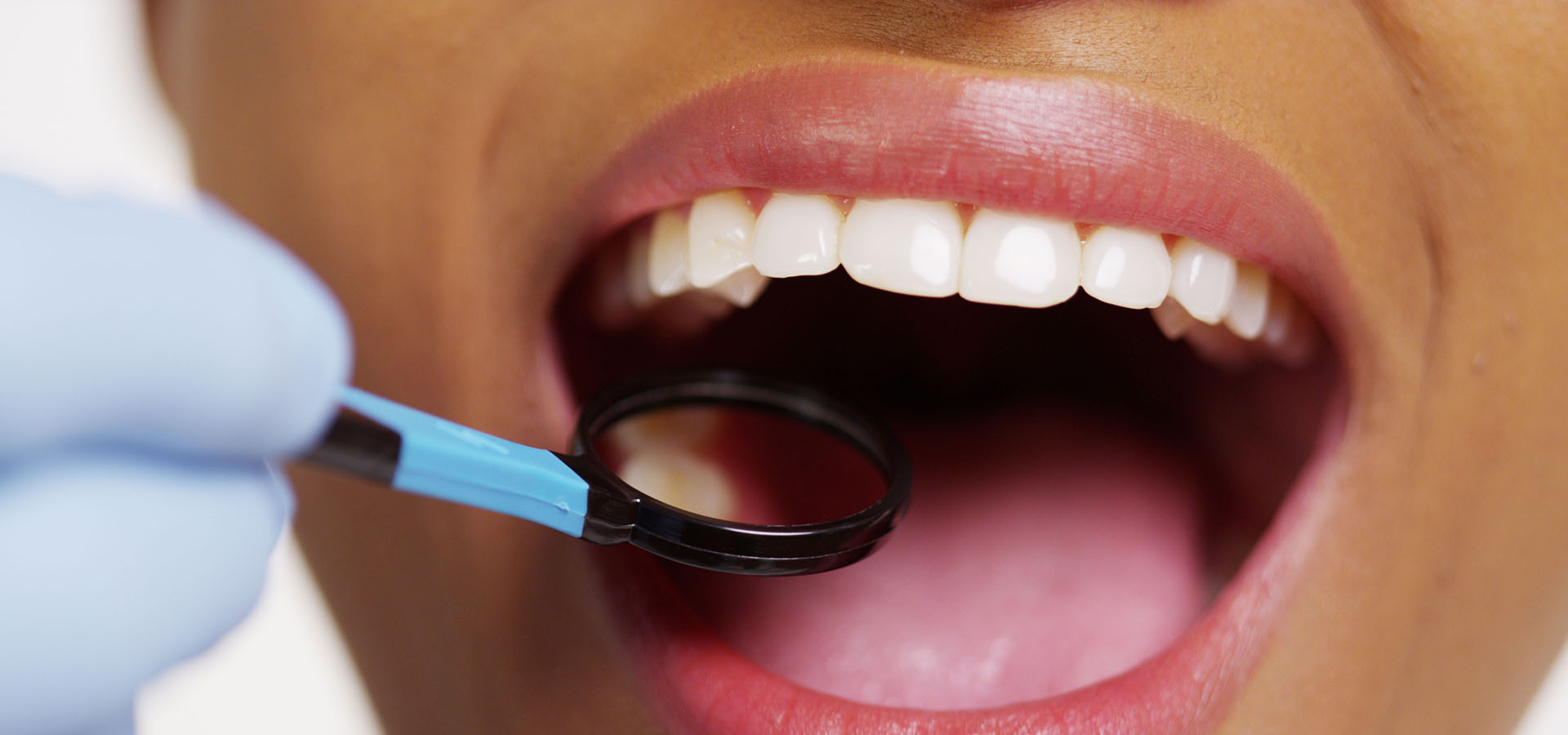 Glass Dental Dr Veeran Home